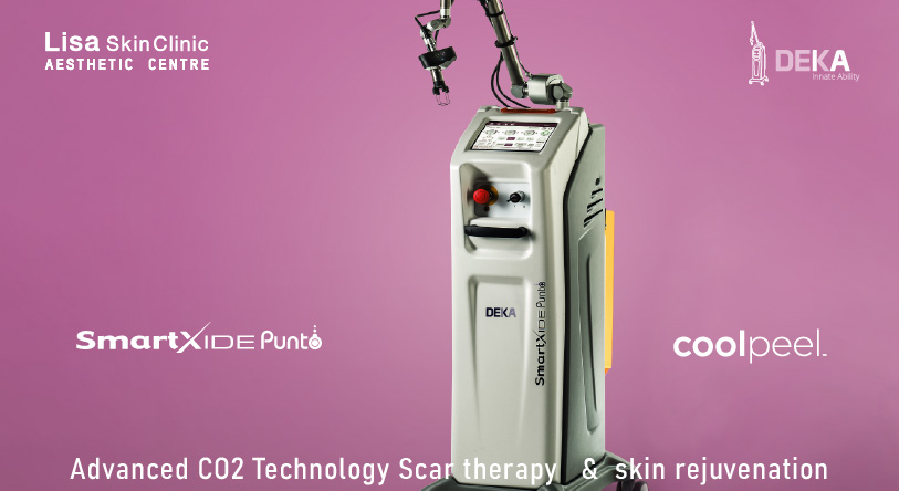 the best ever laser cool peel with smart Xide PUNTO from Deka Laser at Lisa Skin Clinic , Kozhikode, Kerala, India. Damage reversing Laser Skin peel using Laser resurfacing treatments combined with EXOSOME therapy for Skin by Dr Jenny Mathew
